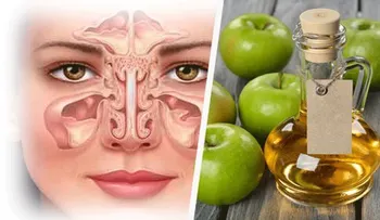 Esta simple técnica te quita la sinusitis para siempre en 30 segundos