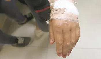 "Te voy a quemar las manos para que no vuelva a coger lo que no es tuyo", le dijo la madre enfurecida a su hijo 11 años 