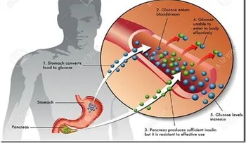 Un hombre se curó de la diabetes tipo 2, con esta toma 