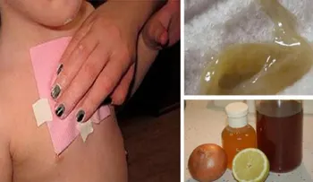 La flemas en los pulmones y las tos no serán nunca más problema con este remedio en una sola noche, sirve para niños y adultos
