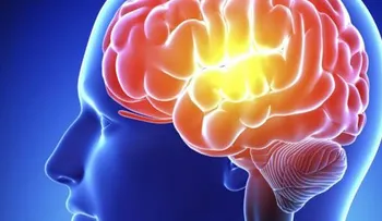 El cerebro también se arruga con la edad