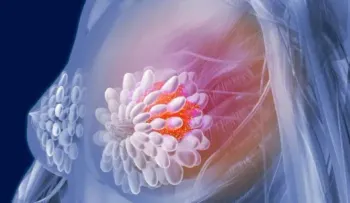 Nanopartículas para transportar un fármaco contra el cáncer de mama