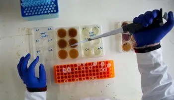 Bacterias multirresistentes a antibióticos son una amenaza mundial