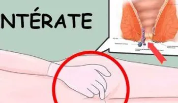 Esta es la razón porque a muchas personas les da cáncer en el ANO y ni cuenta se dan