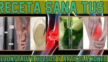 El poderoso remedio para sanar tus huesos y rodillas, que tiene loco a los médicos