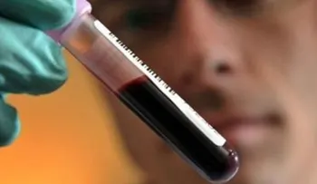 Conocer la hemofilia es vital para el manejo del paciente