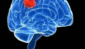 La obesidad aumenta el riesgo de tumores cerebrales