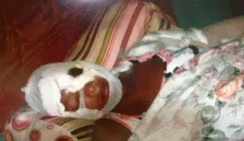 Prisión a dos hombres acusados de lanzar â??ácido del diabloâ? en el rostro de una mujer