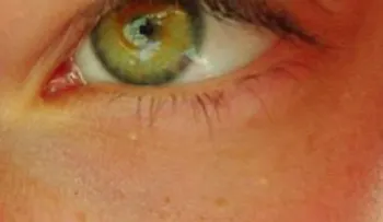 Una crema que elimina sin fallar ojeras y bolsas