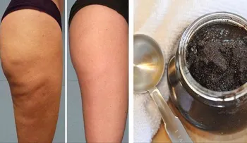 Una taza de café molido, de azúcar y aceite de oliva: remedio brasileño para la celulitis