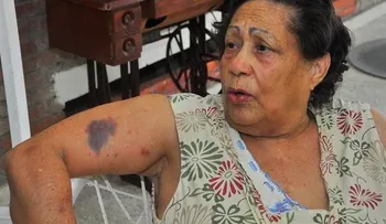 Matan vigilante y agreden señora en Rafey