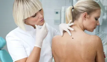 10 síntomas del cáncer que pueden pasar desapercibidos