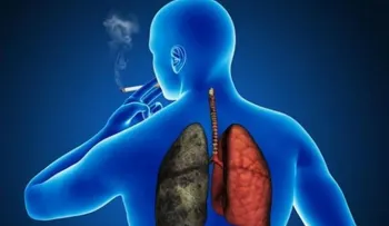 Estudiantes mexicanos desarrollan sistema para identificar pacientes con cáncer de pulmón