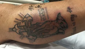 El extraño caso del hombre que murió por nadar poco después de hacerse un tatuaje