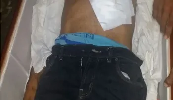 Hallan muerto a un hombre en su vivienda tras herirse al caer sobre una botella (VIDEO)
