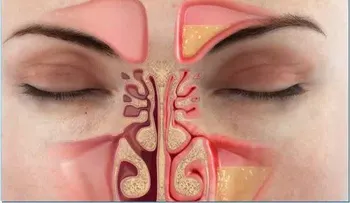Elimina la congestión nasal en menos de un minuto