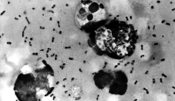 Investigan posible mal manejo de muestras de peste bubónica en laboratorios militares de EE.UU.