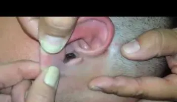 Sentía un fuerte dolor dentro del oídoâ?¦ Cuando lo veas quedará asombrado (VIDEO)