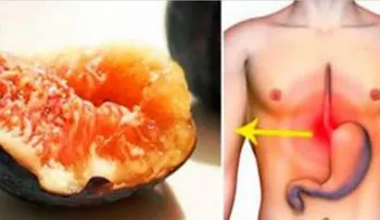 La gastritis acabó con mí estómago y flora intestinal, con este remedio me curé de ella