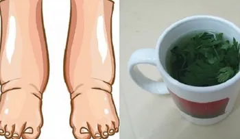 El mejor remedio para las piernas hinchadas con este té