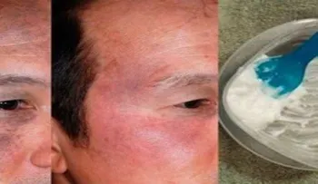 Para para verte joven en minutos: bicarbonato y aceite de coco; por qué no me lo dijeron antes