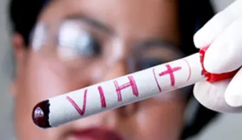 Investigadores encuentran nuevas claves para la curación del VIH