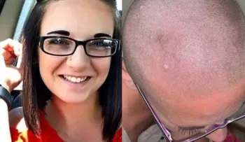 Una mujer se queda calva tras descubrir que su acondicionador fue mezclado con crema depilatoria