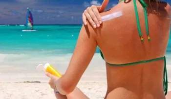 4 naturales para calmar las quemaduras solares
