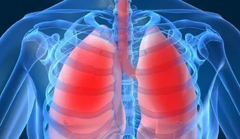  Uso de drogas inhaladas o fumadas puede provocar neumonitis química 
