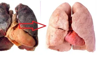 Toma este elixir y limpia tus pulmones cada día hasta dejar el cigarrillo. Los doctores nunca te lo iban a decir