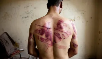 Los crímenes de guerra contra prisioneros son universales en Siria, dice la ONU