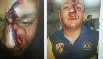 Cristian Casablanca le rompe la cara a joven y es apresado (Video)