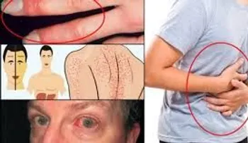 Si te pican los pies, orina color oscuro, siente picazón, náuseas o vómito, puede ser tu hígado 