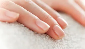 Por esta razón aparecen las manchas blancas en las uñas
