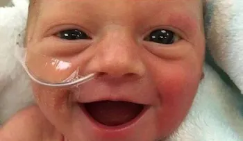 La foto de un bebé prematuro sonriendo que se viraliza