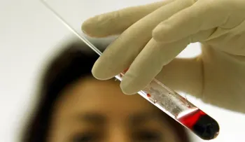 ¿Cómo un laboratorio médico arruinó durante décadas la vida de miles de personas?