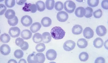 Prueban con éxito un tratamiento más rápido para curar la malaria vivax