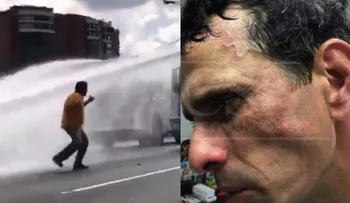 Capriles y el diputado Paparoni, heridos en Venezuela