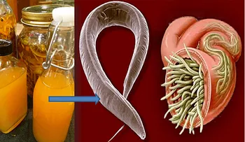 Este poderosísimo antibiótico natural mata los parásitos y cura cualquier infección
