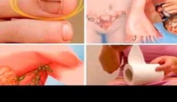 Señales que te avisan de un cáncer