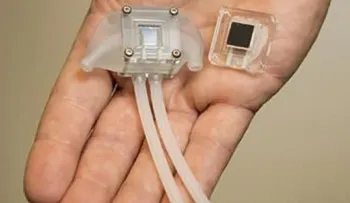 Este es el riñón biónico que te hará vivir muchos años