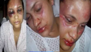 Ministerio Público pedirá prisión contra hombre mató mujer en San Cristóbal