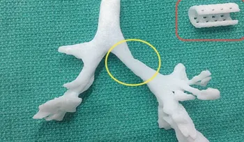 Taiwán trasplantará la primera tráquea impresa en 3D del mundo