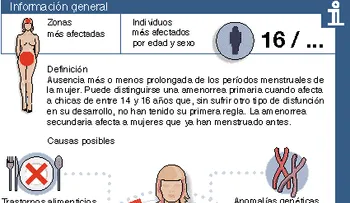 Amenorrea (falta de menstruación en la mujer); tipos de amenorreas y síntomas