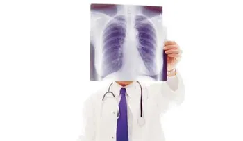 Edema pulmonar, líquido en los pulmones que puede costar la vida (VIDEO)
