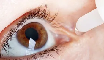 Cómo tratar el síndrome del ojo seco