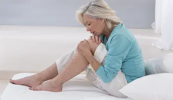 Colágeno, la proteína de la salud para tus articulaciones