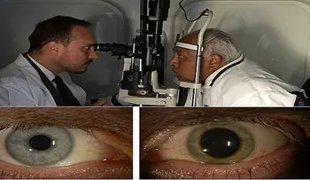 Un anciano de 90 años y casi ciego le dice al Dr. que recuperó la vista un 100% con esta receta 
