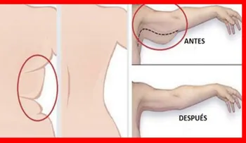 Con café y alcanfor elimina para toda la vida, la flacidez de los brazos. Remedio efectivo en mujeres y hombres 