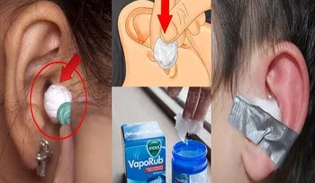 Ella pone Vick Vaporub en una bola de algodón y lo pega en su oido: Momentos después  ¡INCREÍBLE!